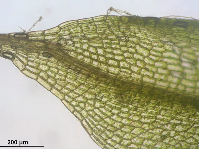 The image shows a close up of a plant stem with a green leaf, which is a photo of a ciliate. At the...